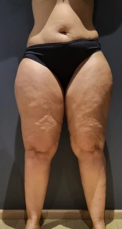 Photo avant des séances de massage dans notre centre de Charleroi